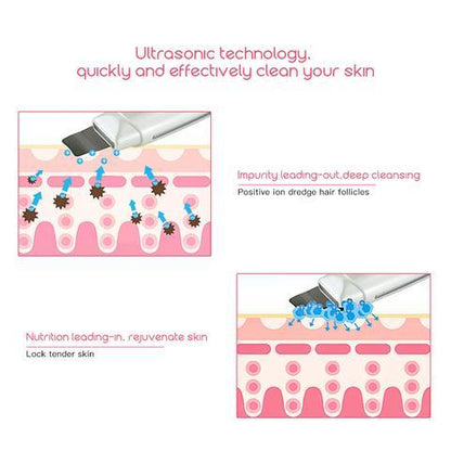 Ultrasonic Skin Scrubber & Facial Cleanser